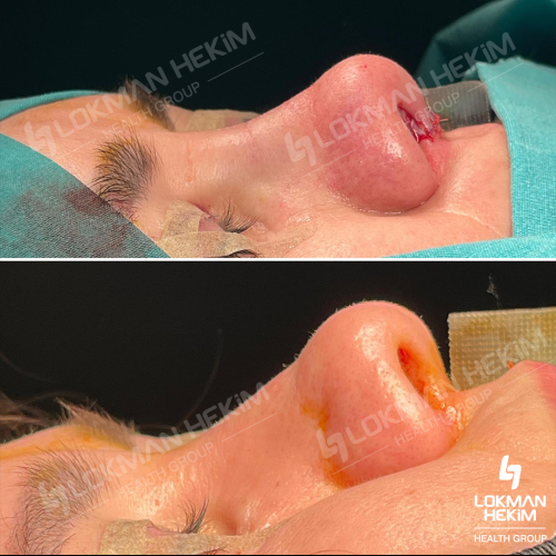 fotos antes y después de nuestros pacientes 8